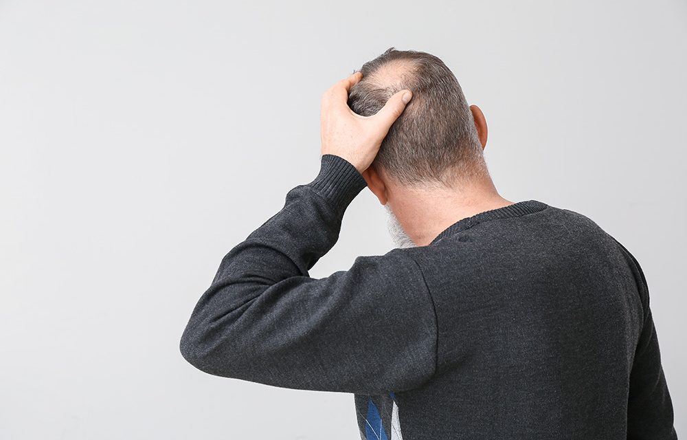 Der blanke Horror, gerade für Männer: Kreisrunder Haarausfall!