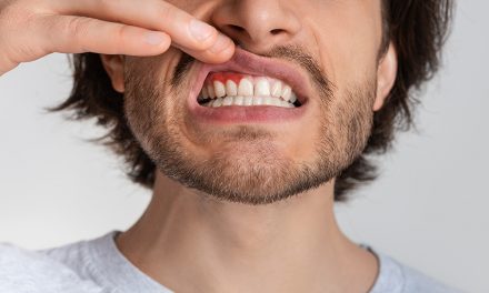 Zahnfleischentzündung – viele sind betroffen