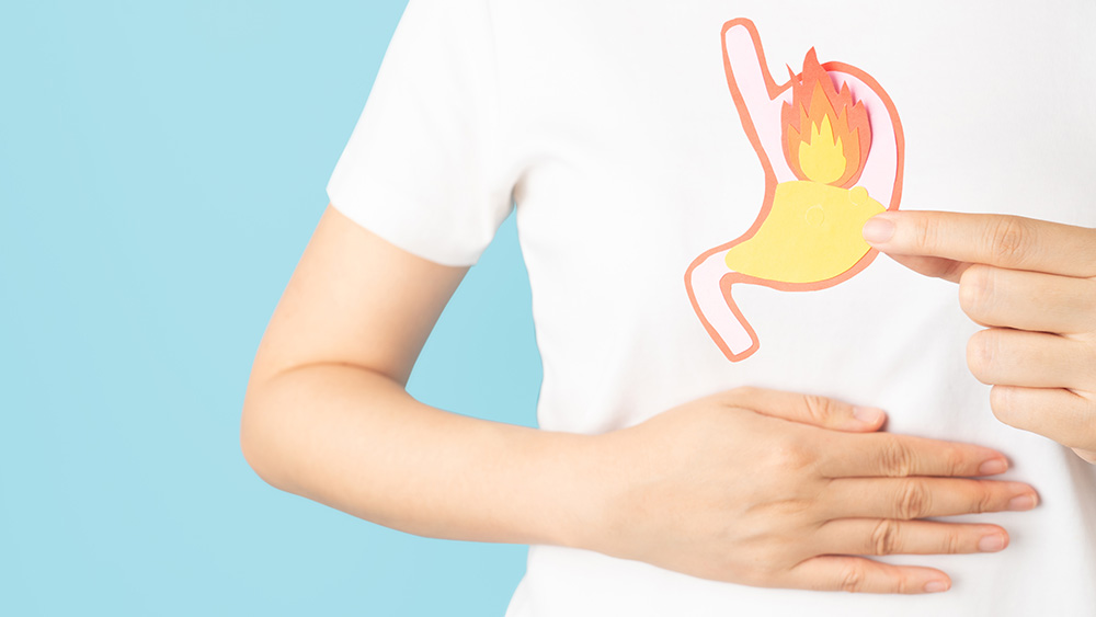 Refluxkrankheit: ein schädlicher Rückfluss der Magensäfte