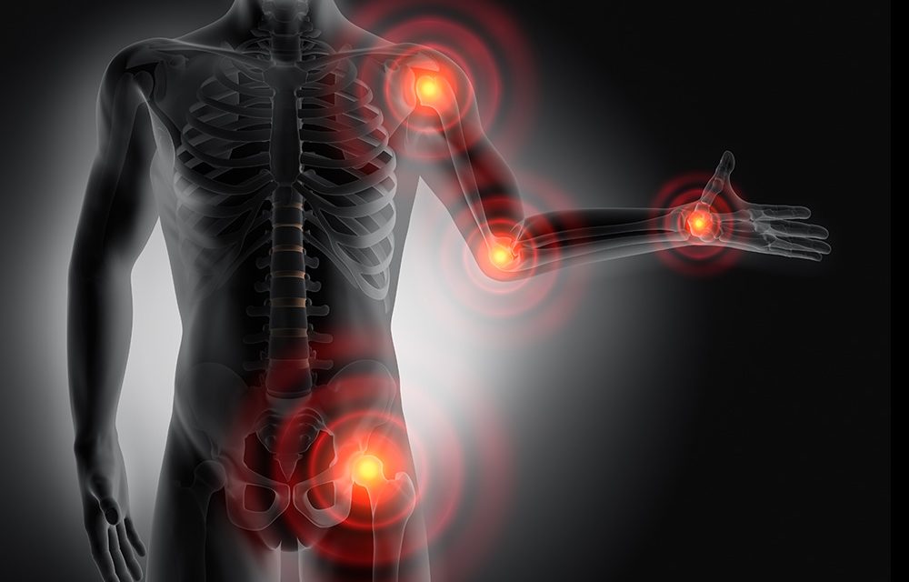 Rheumatoide Arthritis – schmerzhafte Entzündung in den Gelenken