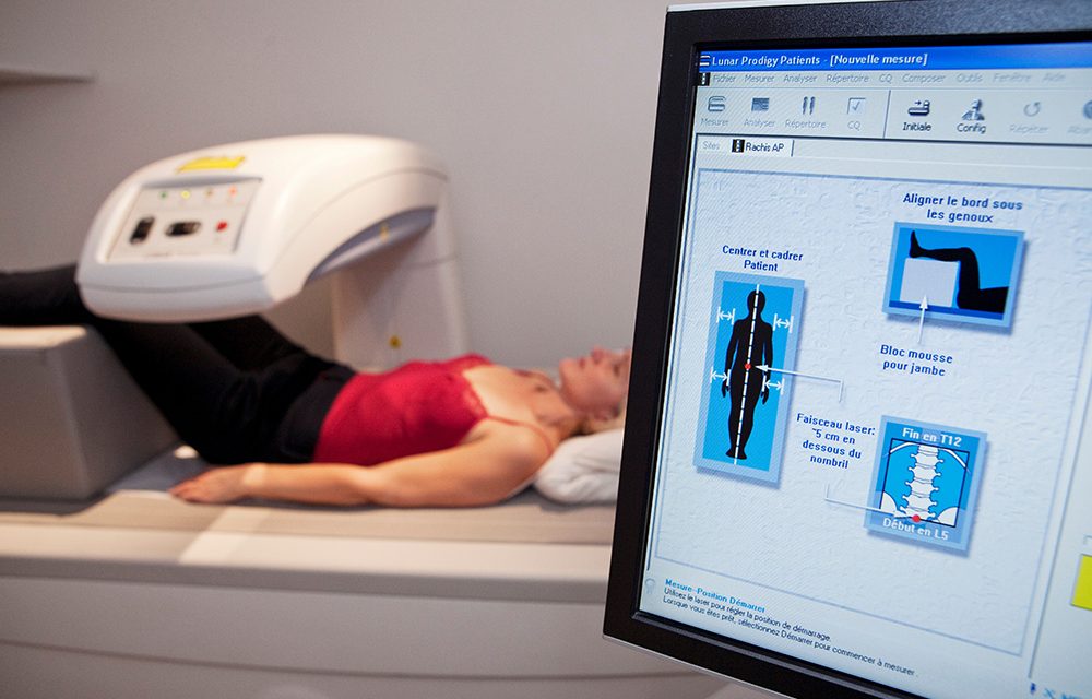 Osteoporose – Rrechtzeitig auf einen knochengesunden Lebensstil achten!