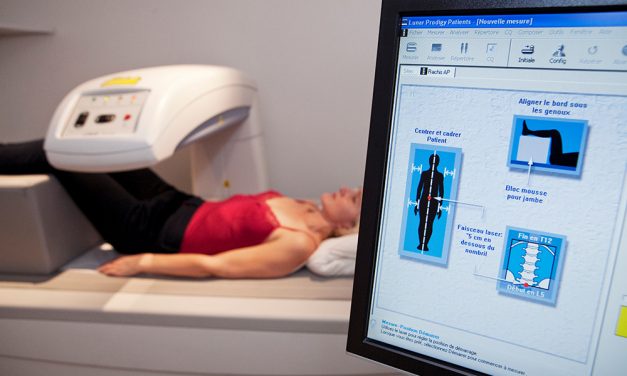 Osteoporose – Rrechtzeitig auf einen knochengesunden Lebensstil achten!