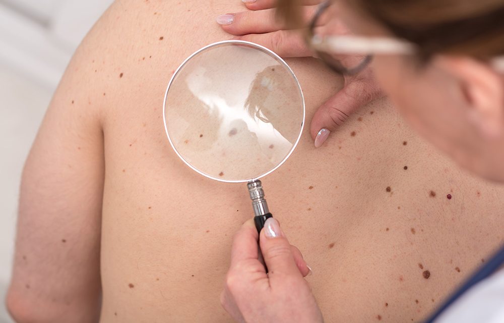 Therapie gegen schwarzen Hautkrebs zeigt Wirkung