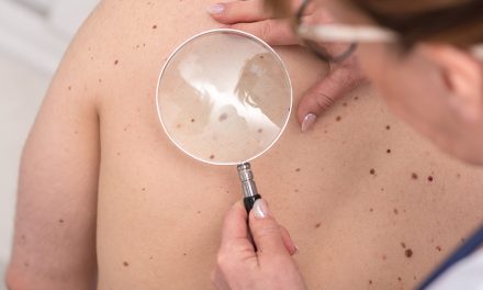 Therapie gegen schwarzen Hautkrebs zeigt Wirkung