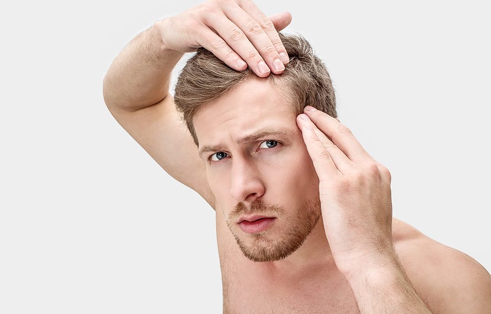Haarausfall – ein Schicksal der Männer?