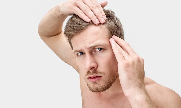 Haarausfall – ein Schicksal der Männer?