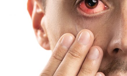 Bindehautentzündung – wenn das Auge rot sieht