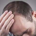 Haarausfall – für Betroffene ein echtes Problem