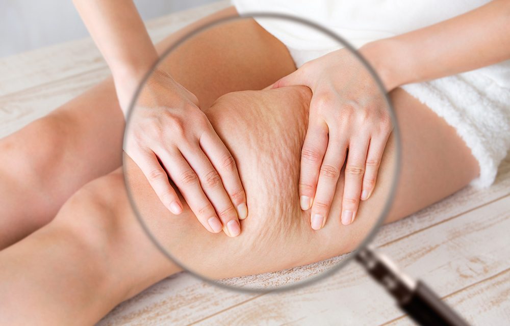 Lymphödeme – Wenn die Lymphbahnen dicht machen