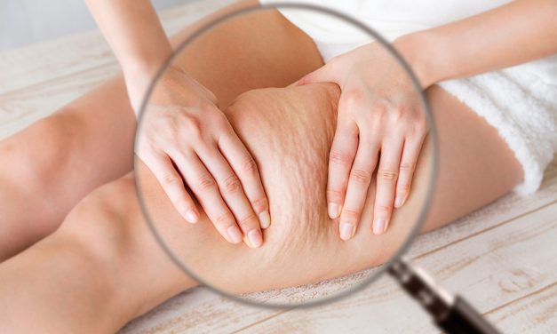 Lymphödeme – Wenn die Lymphbahnen dicht machen