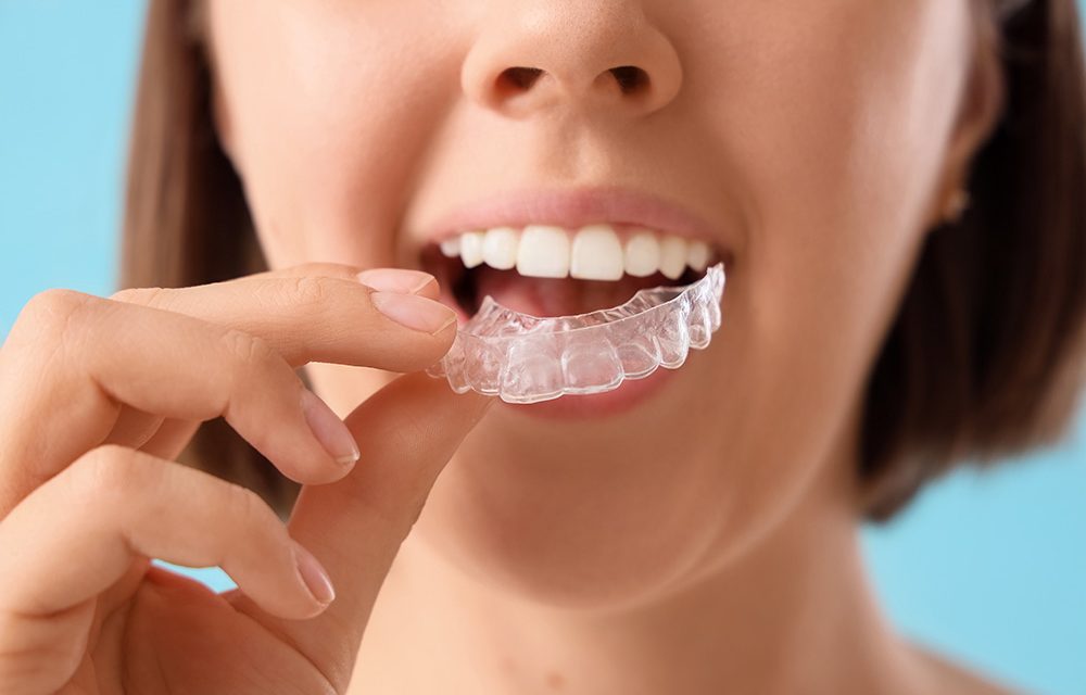 Zähneknirschen – Wenn die Zähne nachts weiterarbeiten