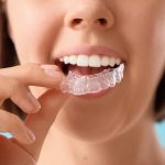 Zähneknirschen – Wenn die Zähne nachts weiterarbeiten