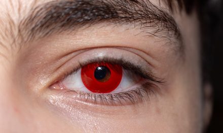 Bunte Linsen – ein gefährlicher Partyspaß