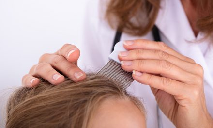 Wie man Läuse effektiv bekämpft