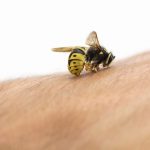 Hilfe, ein Insektenstich!