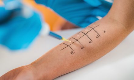 Allergien: Ursachen und Behandlungsmethoden