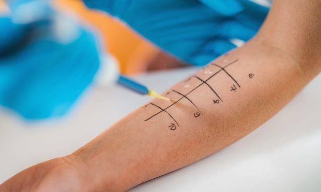 Allergien: Ursachen und Behandlungsmethoden