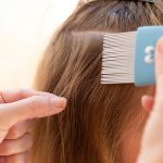 Läuse – Parasitenalarm im Kindergarten