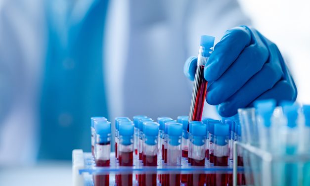 Worauf Patienten bei einer Blutanalyse achten müssen