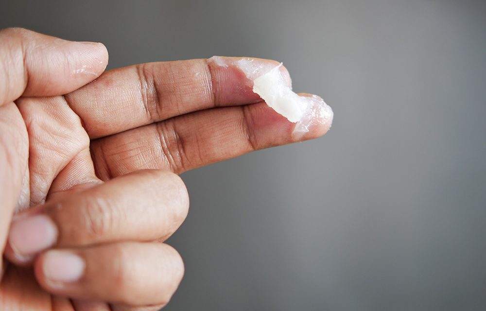 Wirksamer Hautschutz im Sommer