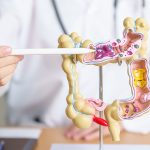 5 Prinzipien für einen gesunden Darm