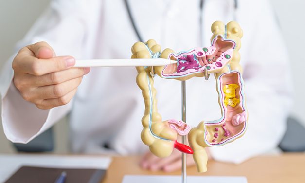 5 Prinzipien für einen gesunden Darm