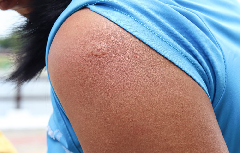 Lebensgefahr bei Insektenstichen