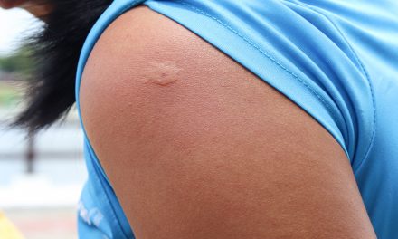 Lebensgefahr bei Insektenstichen